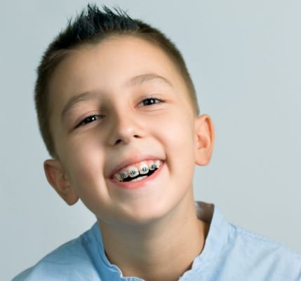 braces-for-kids